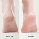 Hotosu Stainless Steel Foot File Callus Remover (Beige) 9