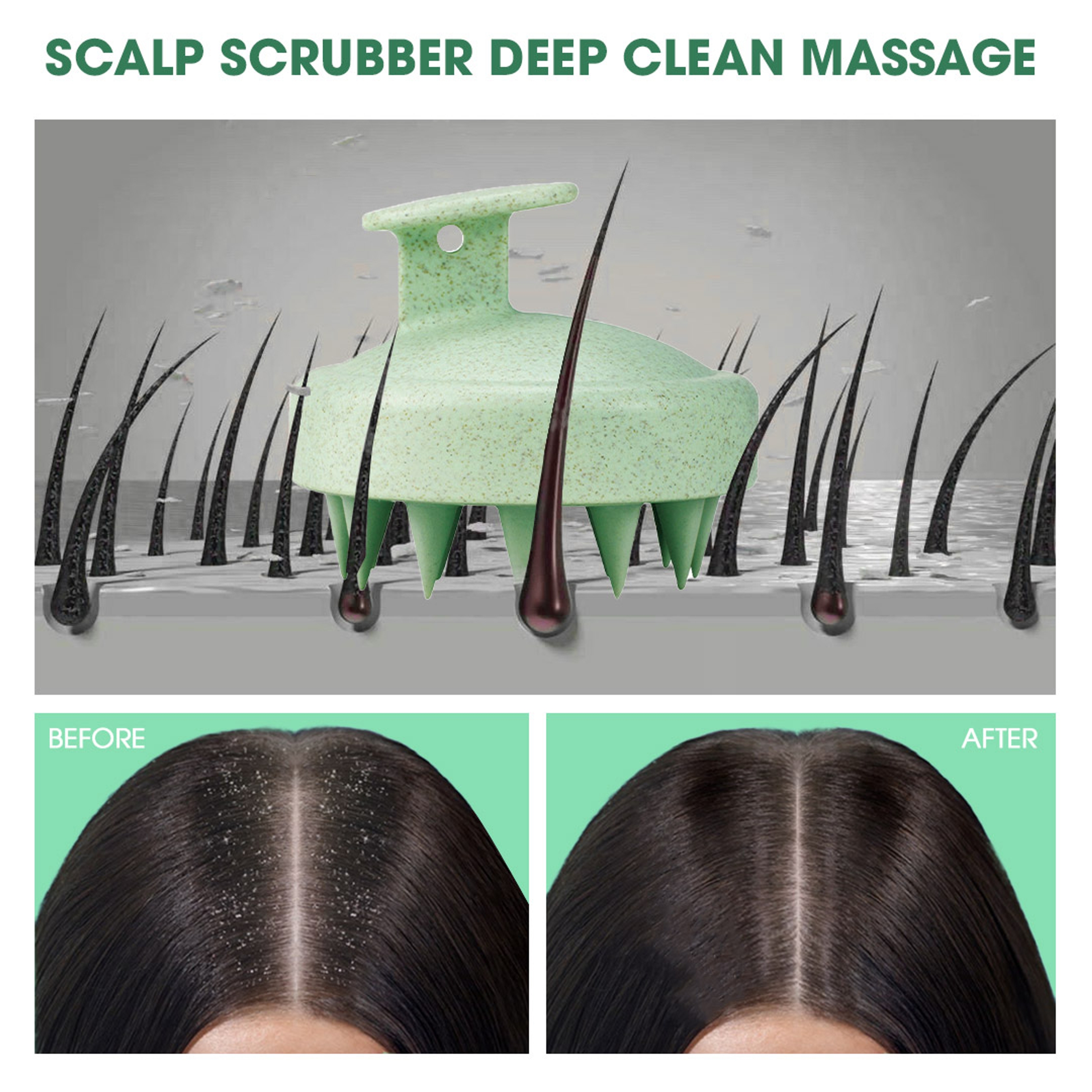 Hotosu Silicone Scalp Massager Brush for Hair Growth (Green) 8