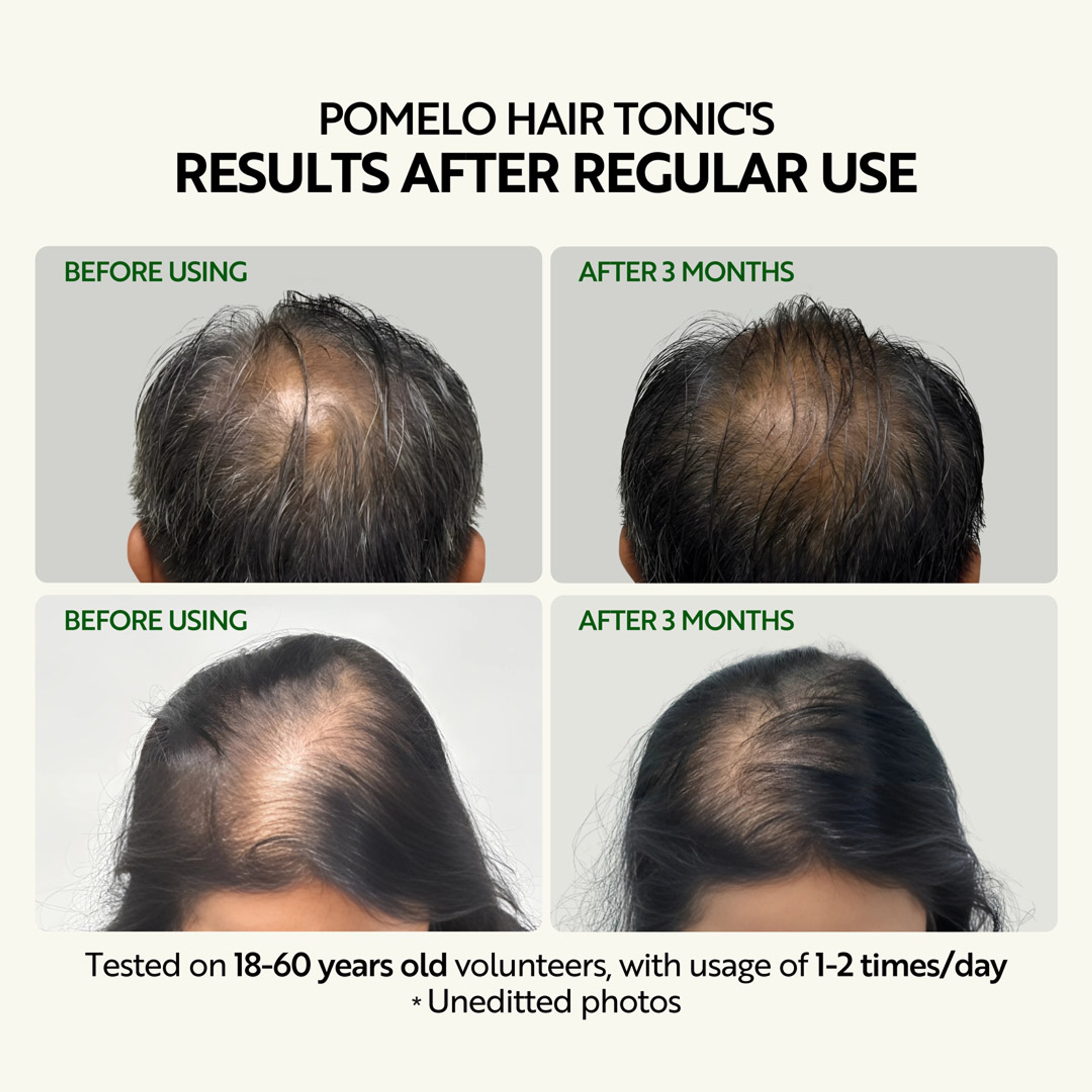 Cocoon Pomelo Hair Tonic 4.7 fl.oz - Reduces Hair Fall, Nourishes Scalp & Softens Hair 6