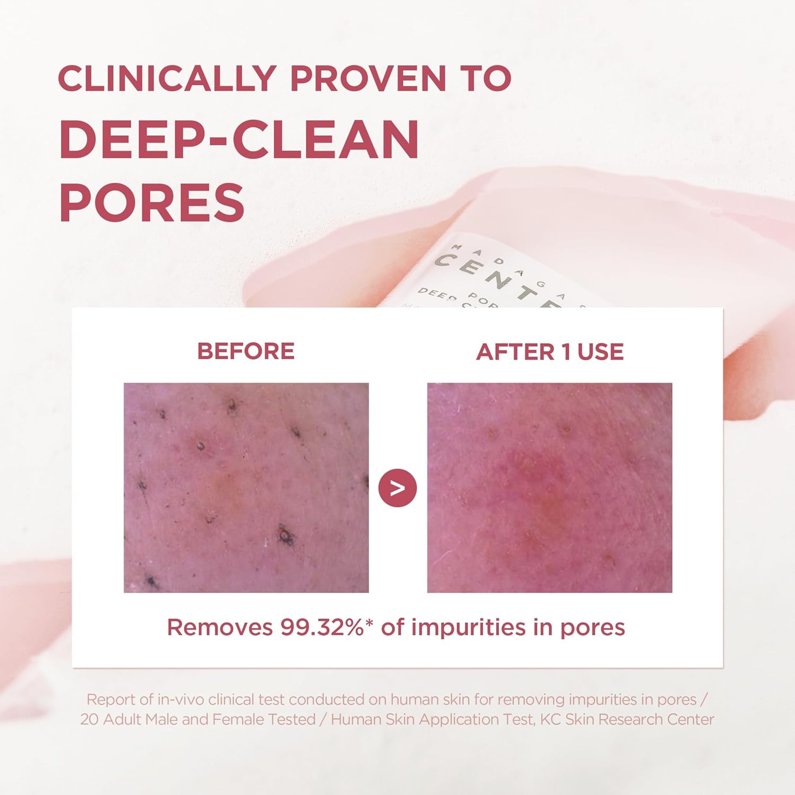 Skin1004 Poremizing Deep Cleansing Foam 4.23 fl.oz - Face Cleanser for Facial Pore Cleansing 3