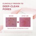 Skin1004 Poremizing Deep Cleansing Foam 4.23 fl.oz - Face Cleanser for Facial Pore Cleansing 3