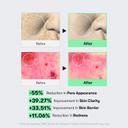 VT Cosmetics CICA Reedle Shot 100 1.69 fl.oz - Spicule Microneedling Serum for Pore Care & Exfoliation 6