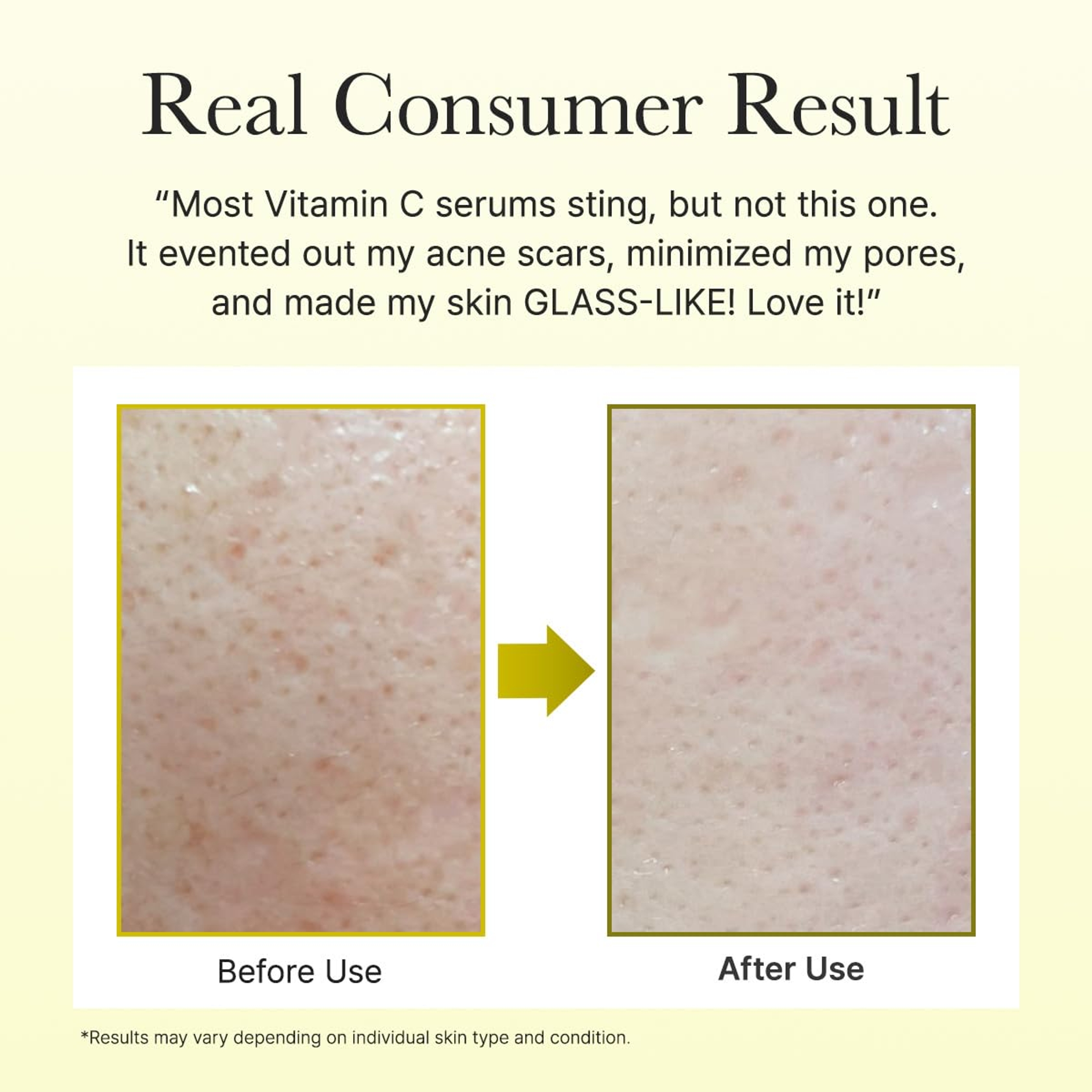 Arencia Vitamin C Booster Shot 1.01 fl.oz - Face & Eye Cream Moisturizer for Dark Spot Care, Fine Lines & Wrinkles 7