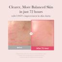 Medicube TXA + Niacinamide 15% Serum 1.01 fl.oz - Glow Facial Serum for After Spot Care 3