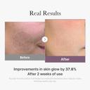 Medicube Age-R Glutathione Glow Capsule Cream 1.69 fl.oz - Instant Lifting Moisturizer & Improve Blemishes 5