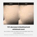 Medicube Zero Pore One Day Serum - Overnight Resurfacing Serum with Pore Tightening Complex 1.01 fl.oz 6