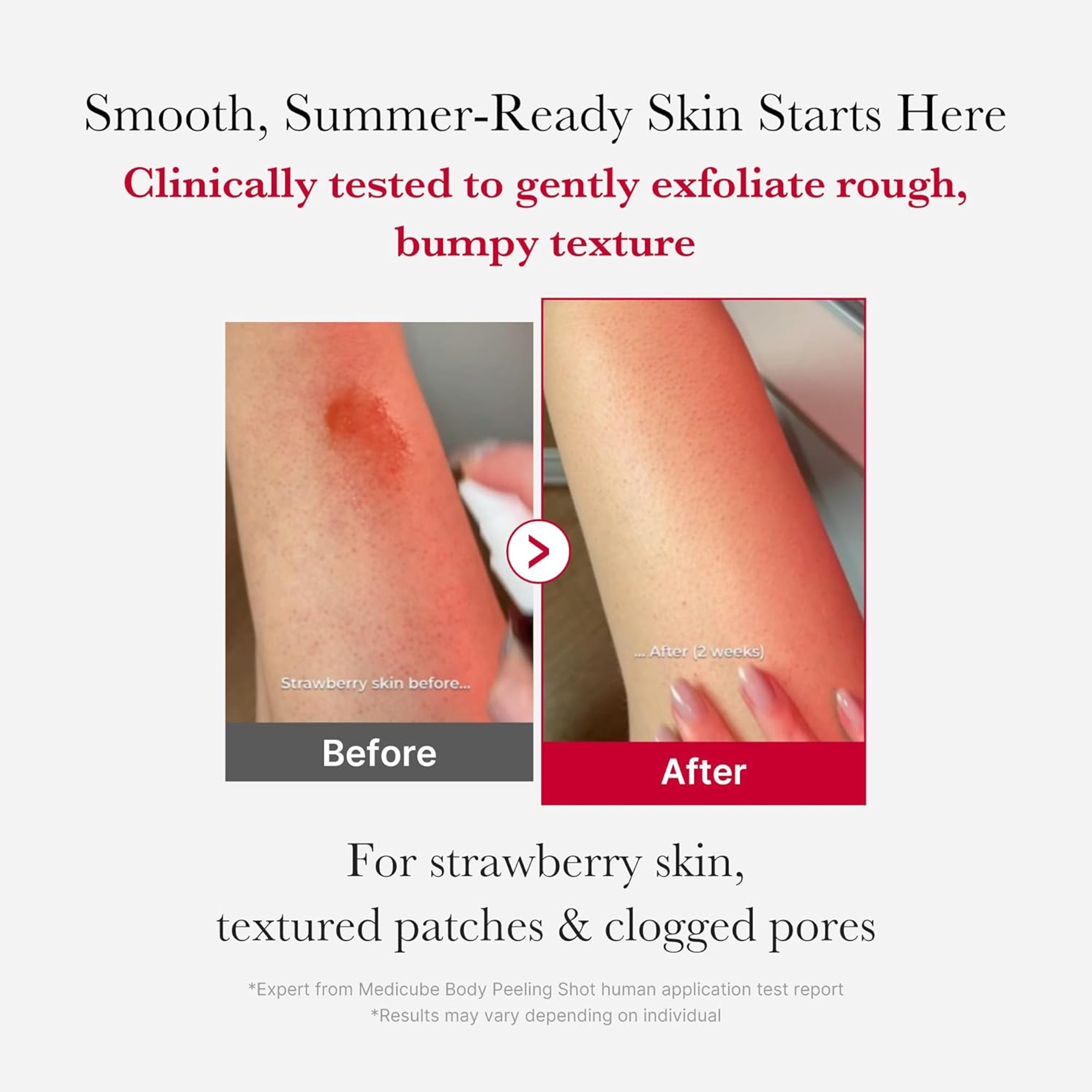 Medicube Red Body Peeling Shot Cleanser 3.88 oz - AHA-BHA Exfoliating Body Spray for Strawberry Skin 2