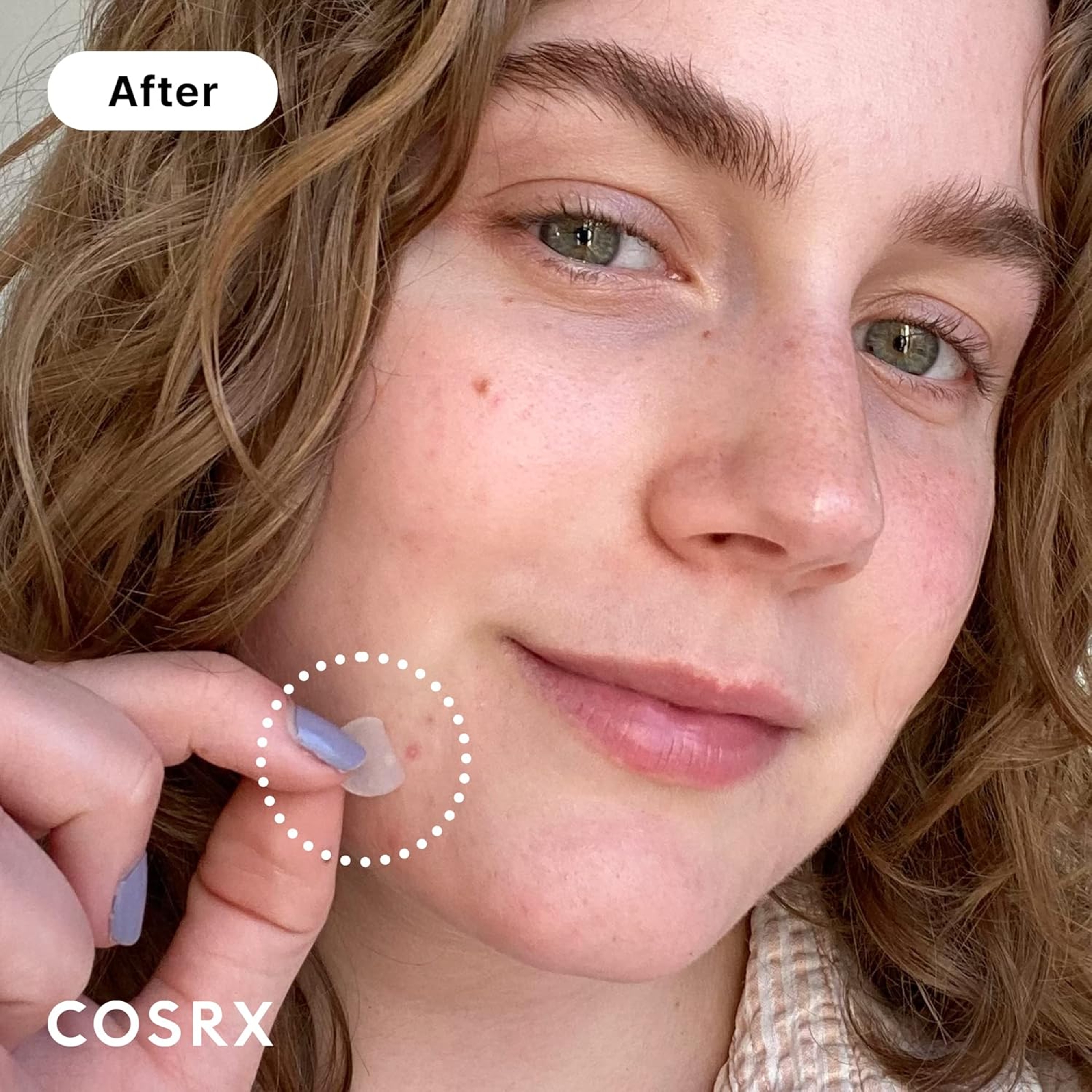 Cosrx Acne Pimple Master Patch 24 Count - Absorbing Hydrocolloid for Blemishes and Zits Cover 3