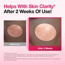 Anua Niacinamide 10 + TXA 4 Serum 1.01 fl.oz - Lightweight & Hydrating All-in-One Daily Facial Serum for Glass Skin 5