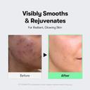 VT Cosmetics CICA Reedle Shot 300 1.69 fl.oz - Microneedling Serum for Soft & Smooth Skin 5