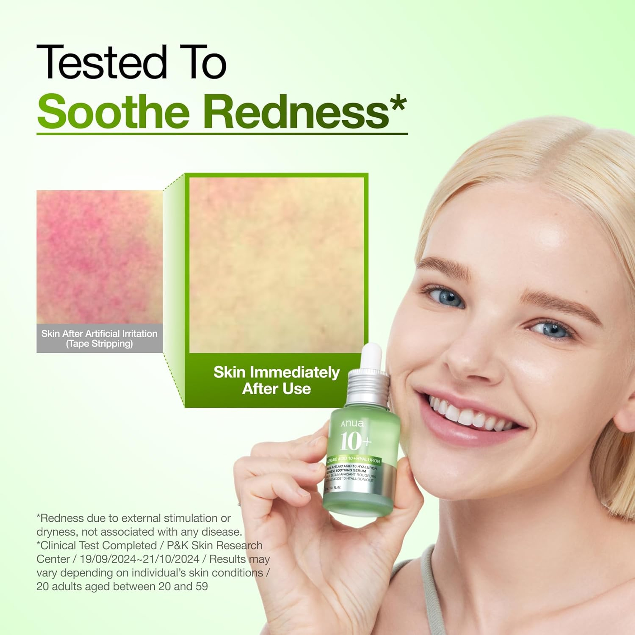Anua Azelaic Acid 10 Hyaluron Redness Soothing Serum 1.01 fl.oz - Facial Serum for Blemish-Prone & Oily-Prone Skin 5