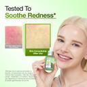 Anua Azelaic Acid 10 Hyaluron Redness Soothing Serum 1.01 fl.oz - Facial Serum for Blemish-Prone & Oily-Prone Skin 5