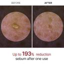 Dr.Melaxin Peel Shot Glow White Rice Peeling Ampoule 2.7 fl.oz - Brightening & Gentle Exfoliating Serum for Sebum Control 3