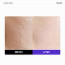 Frankly Closer Serum - Pore Minimizer Serum for Glass Skin, Anti-Aging, Hydration, Elasticity 1.01 fl.oz 2