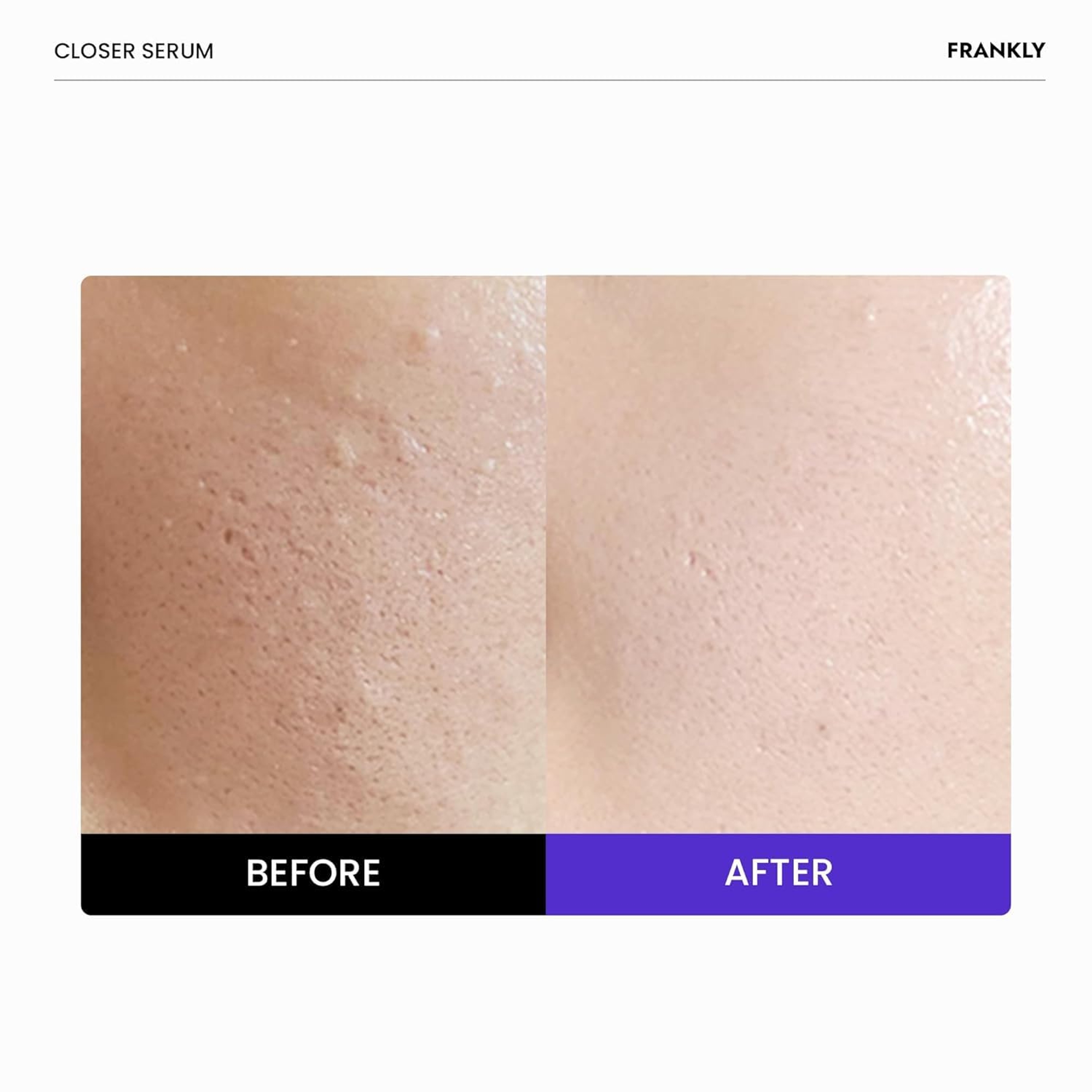 Frankly Closer Serum - Pore Minimizer Serum for Glass Skin, Anti-Aging, Hydration, Elasticity 1.01 fl.oz 2