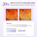 Mary & May TXA + Glutathione Eye Cream 1.01 fl.oz - Fragrance-Free Under Eye Cream for Dark Circles & Uneven Tone 5