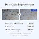 Medicube Zero Pore Blackhead Mud Mask 3.52 fl.oz - Skin Cooling & Pore Tightening 5