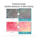 Medicube Azelaic Acid Capsule Cleansing Foam 4.23 fl.oz - Soothing Daily Foam Cleanser for Troubled Skin 4