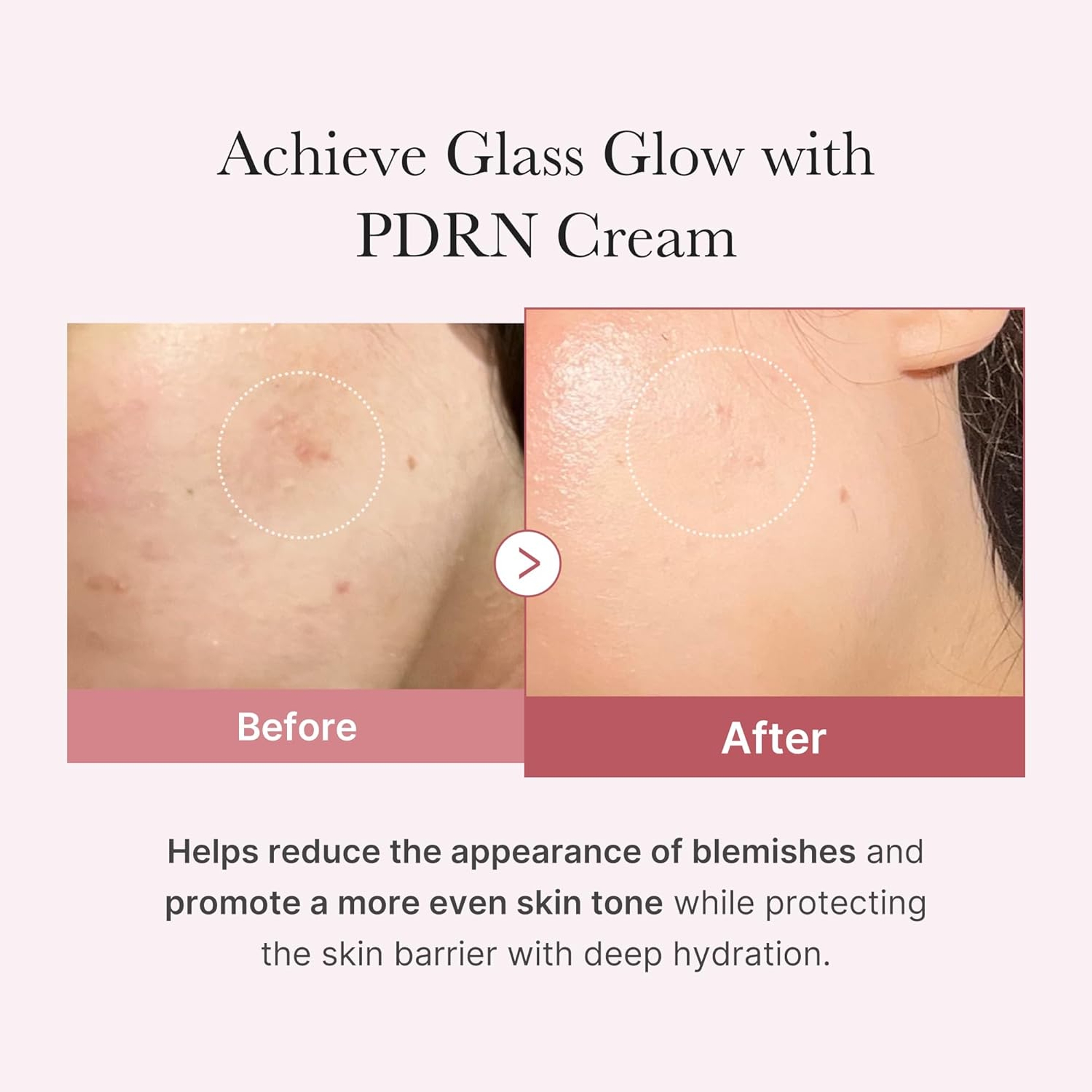 Medicube PDRN Pink Hyaluronic Moisturizing Cream 1.69 fl.oz - Restores Skin Elasticity & Glow 3
