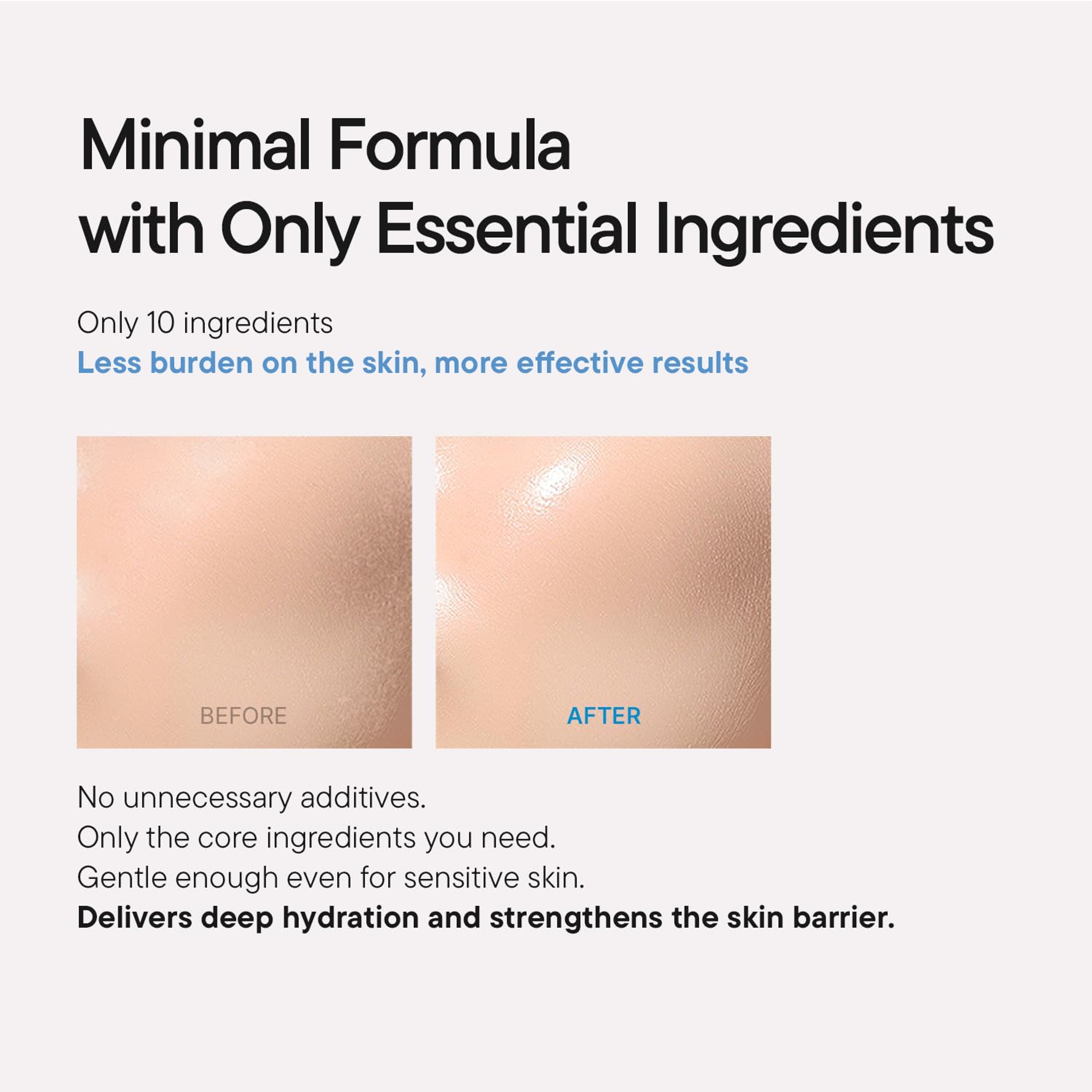 iUNIK Beta-Glucan Power Moisture Serum - Deep Hydration Vegan Serum for Dry, Mature & Sensitive Skin 1.69 fl.oz 5