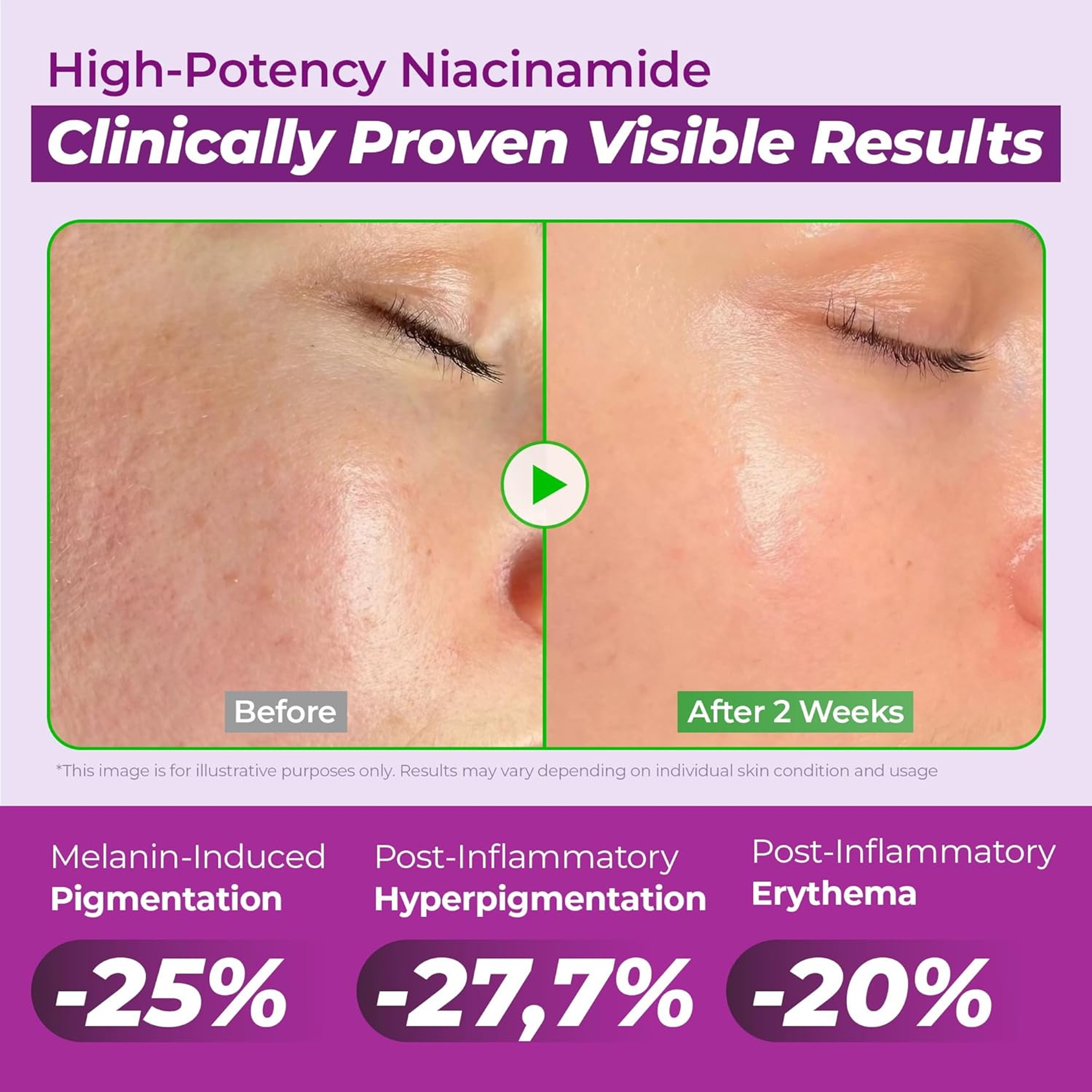 Jumiso 20% Niacinamide Dark Spot Serum - TXA & Glutathione Serum Helps Even Skin Tone 1.35 fl.oz 3