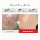 Medicube Red Succinic Peeling Pad 5.46 fl.oz (70 Pads) - Exfoliating Toner Pad for Breakout-Prone Skin 4