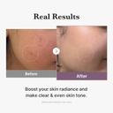 Medicube Age-R Glutathione Glow Toner 4.73 fl.oz - Low-Irritation Double Layer Toner for Glass Glow Skin 5