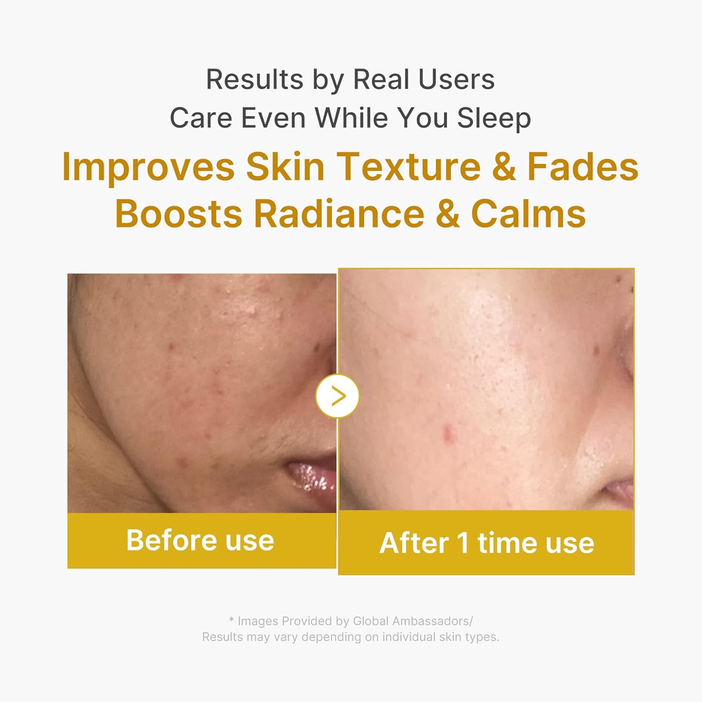 Medicube Kojic Acid Turmeric Night Wrapping Mask 2.53 fl.oz - Overnight Peel Off Facial Mask for a Glowing Complexion 5