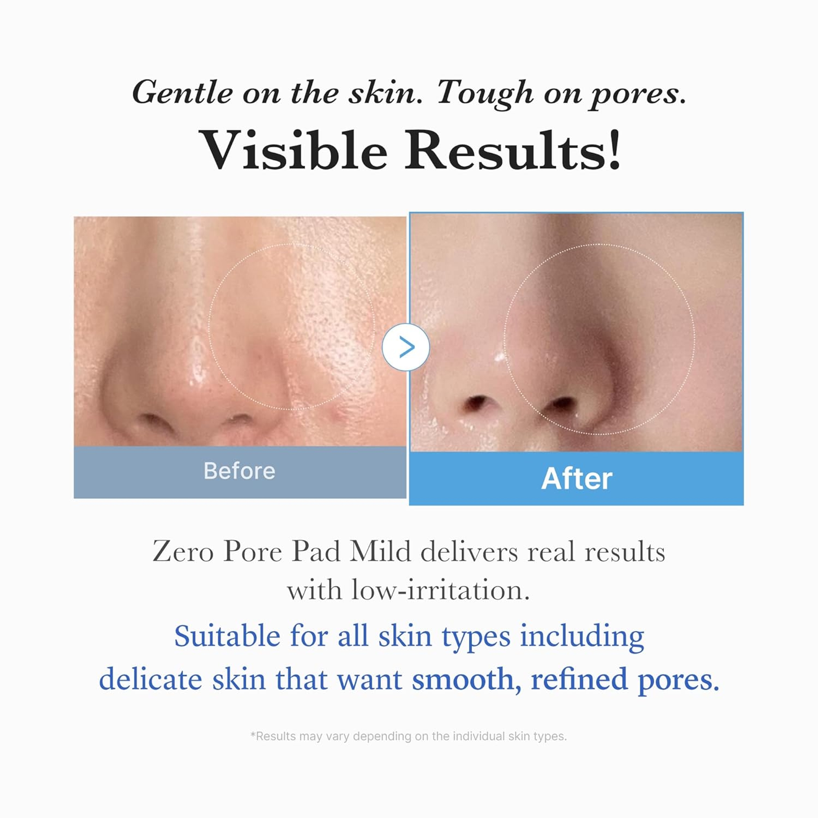 Medicube Zero Pore Pad Mild 5.46 fl.oz (70 Pads) - Gentle Calming Toner Pad for Exfoliation, Minimizing Pores 14