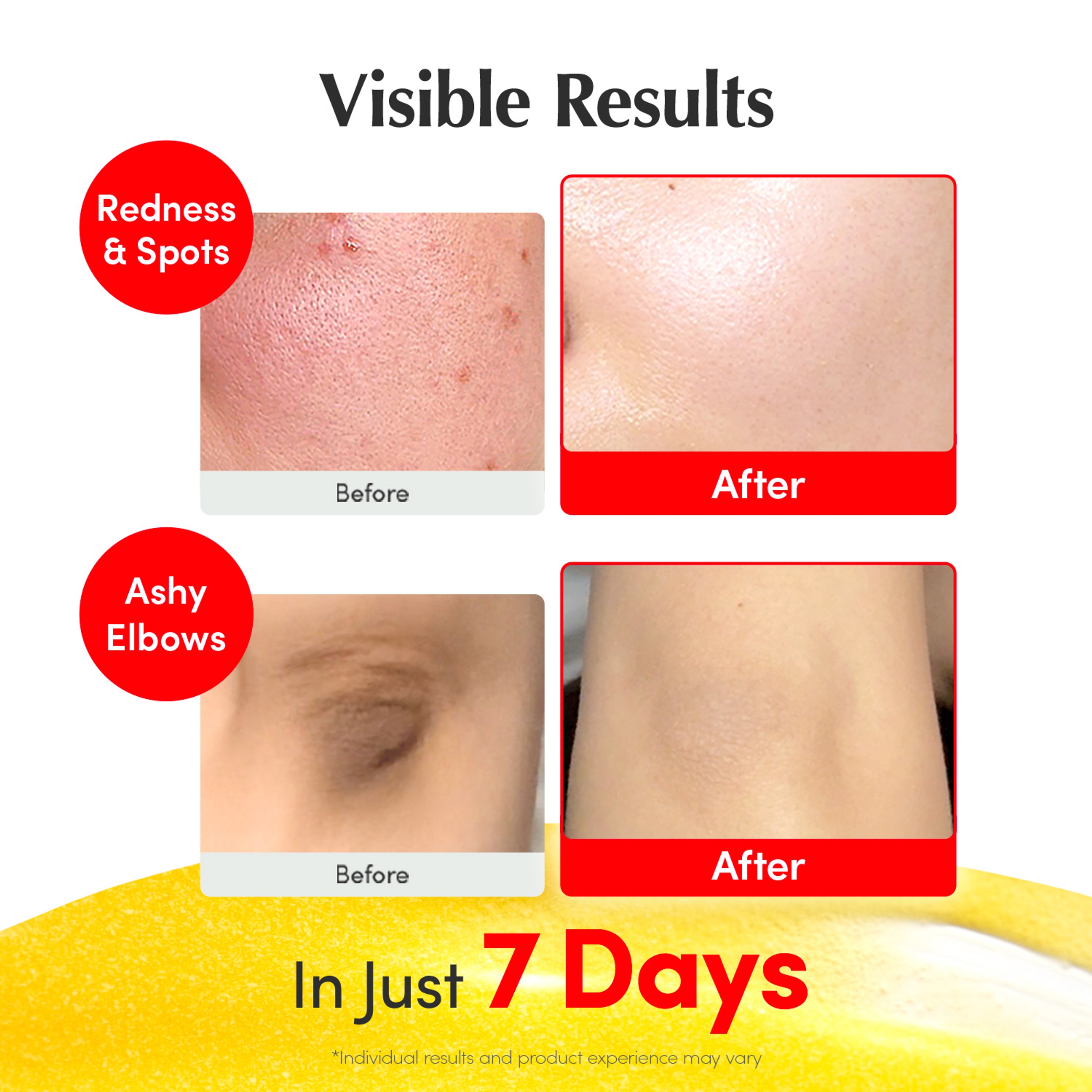 Eqqualberry Vitamin Illuminating Serum 1.01 fl.oz - Brightening Vitamin C Serum for Dark Spot & Uneven Skin 4