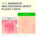 Eqqualberry Aloe PDRN Calming Serum - Cica & Aloe Soothing Serum for Sensitive Skin 1.01 fl.oz 5