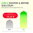 Eqqualberry Aloe PDRN Calming Serum - Cica & Aloe Soothing Serum for Sensitive Skin 1.01 fl.oz 4