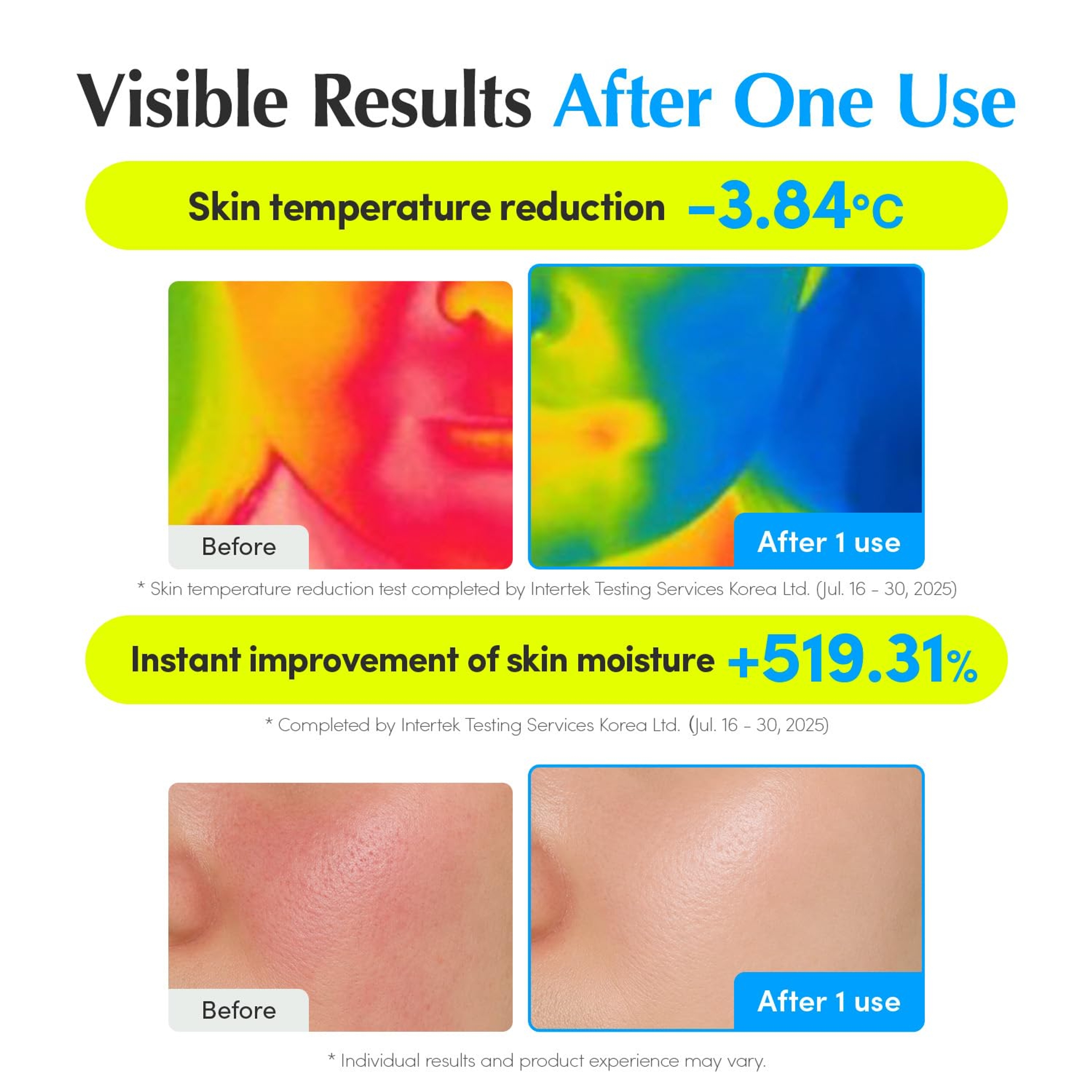 Eqqualberry Hyaltoin Flooding Serum - Deep Hydrating Cooling Care Serum for Face & Redness Relief 1.01 fl.oz 5