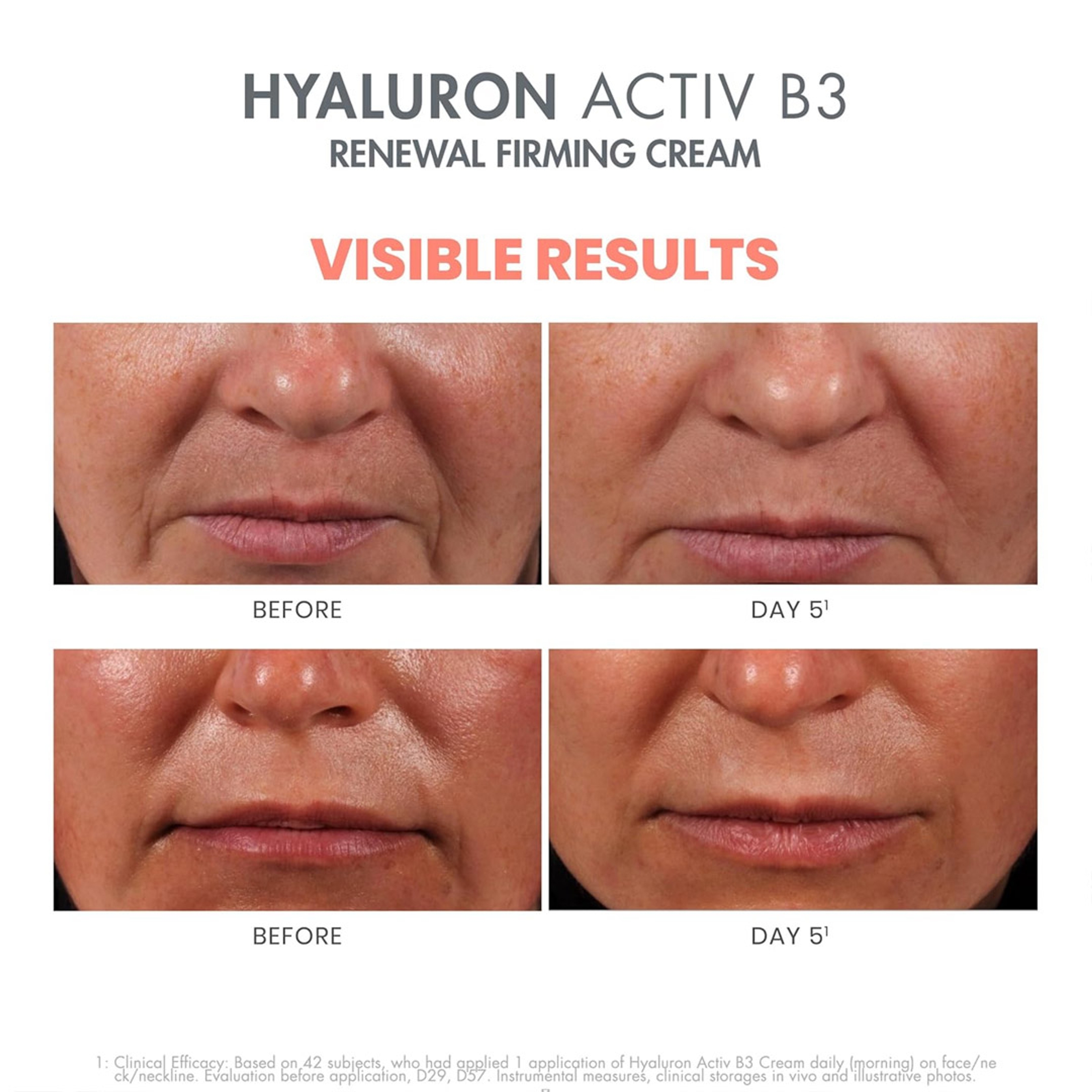 Avène Hyaluron Activ B3 Renewal Firming Cream 1.6 fl.oz - Daily Moisturizer for Radiant & Healthy Skin 7