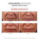 Avène Hyaluron Activ B3 Renewal Firming Cream 1.6 fl.oz - Daily Moisturizer for Radiant & Healthy Skin 7