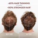 Klorane Strengthening Shampoo with Quinine - Natural Alternative Thickening Shampoo for Hair Thinning 13.5 fl.oz 4