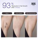 Ulike Air 4 IPL Laser Hair Removal Device - Ice Cool and Permanent Hair Reduction for Women & Men 2