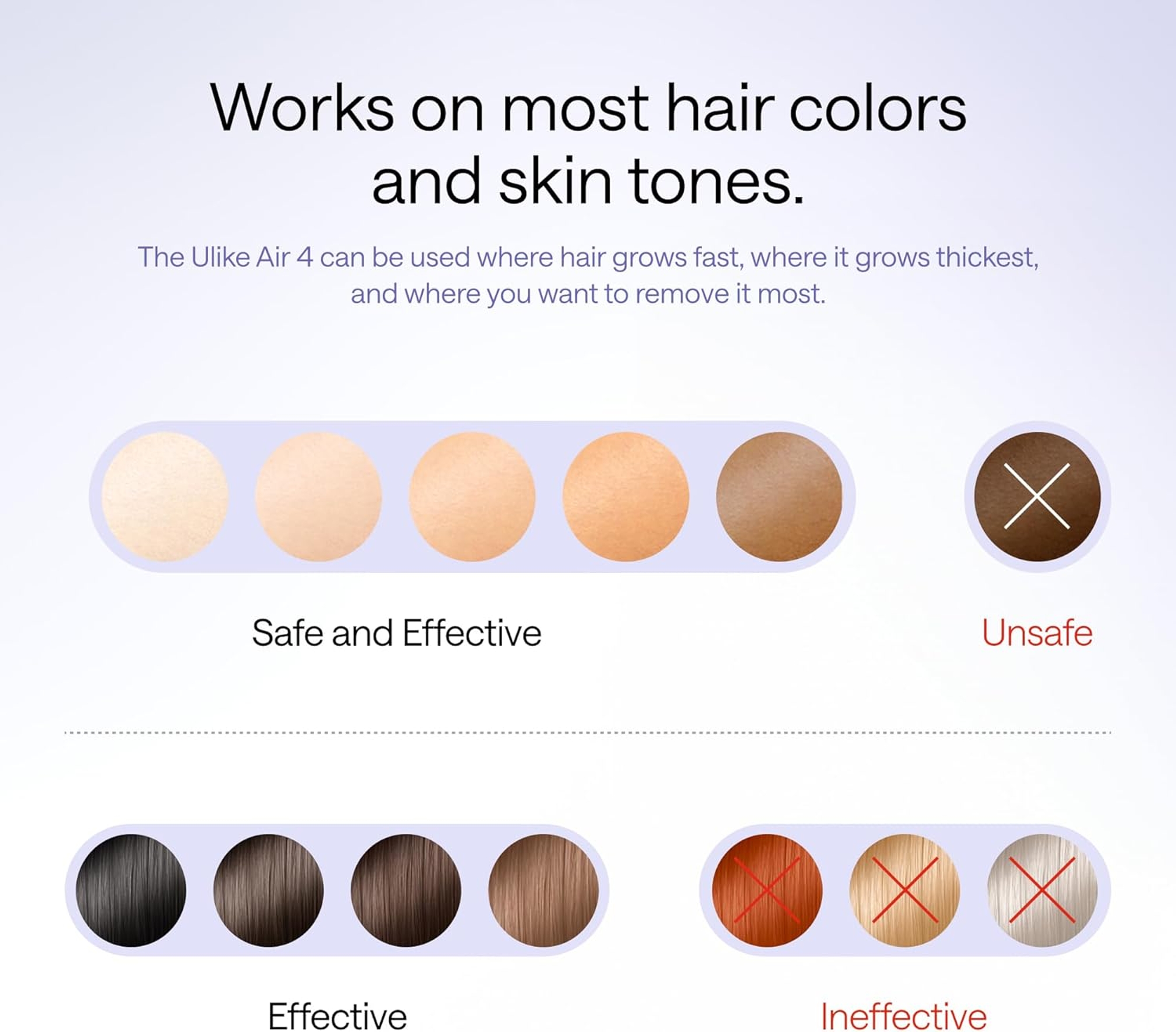 Ulike Air 4 IPL Laser Hair Removal Device - Ice Cool and Permanent Hair Reduction for Women & Men 5