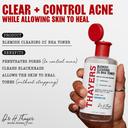 Thayers Blemish Clearing 2% BHA Toner 12 fl.oz - Salicylic Acid Acne Treatment Face Toner 2