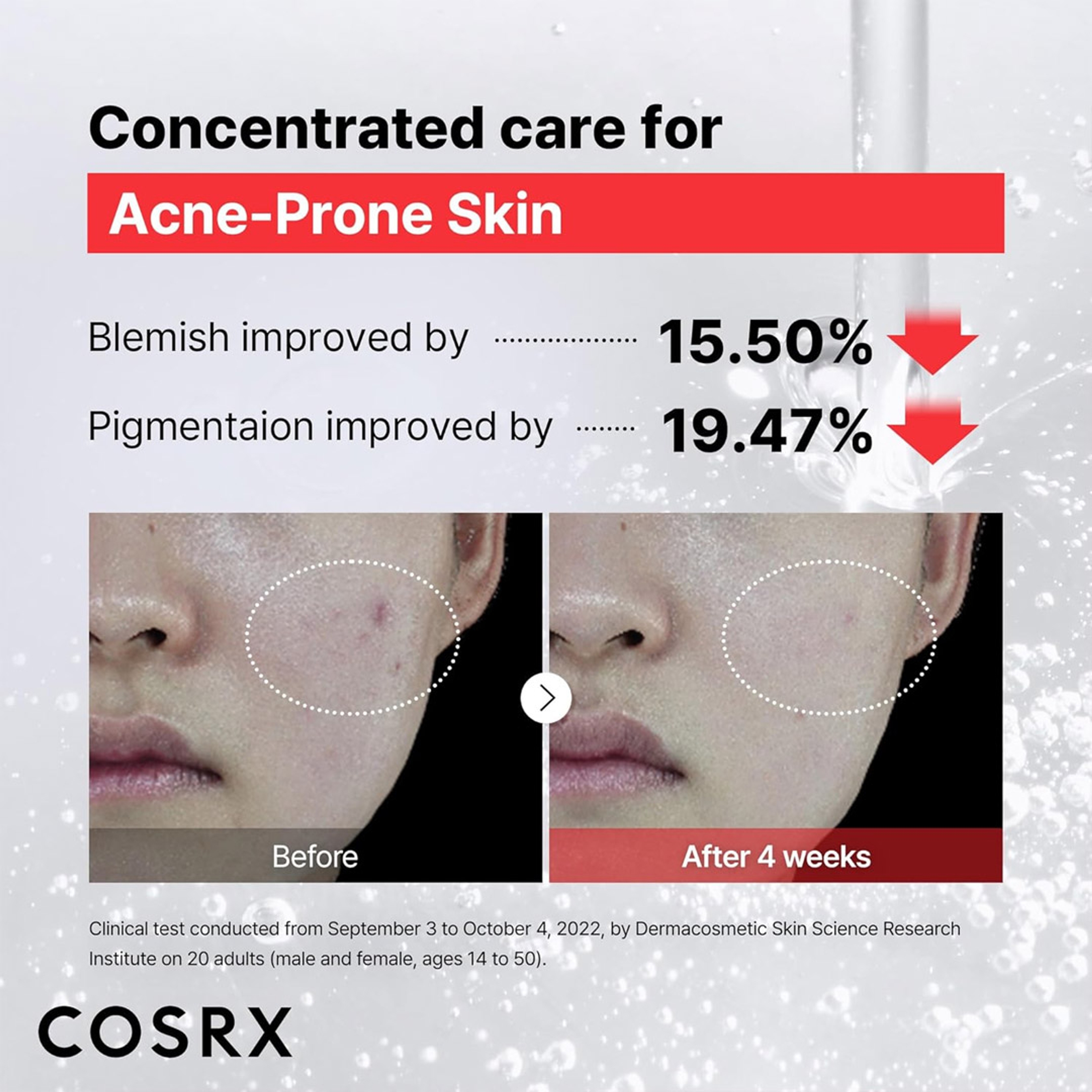 Cosrx The Niacinamide 15 Serum - Pore Minimizer Serum for Uneven Skin Tone 0.67 fl.oz 5