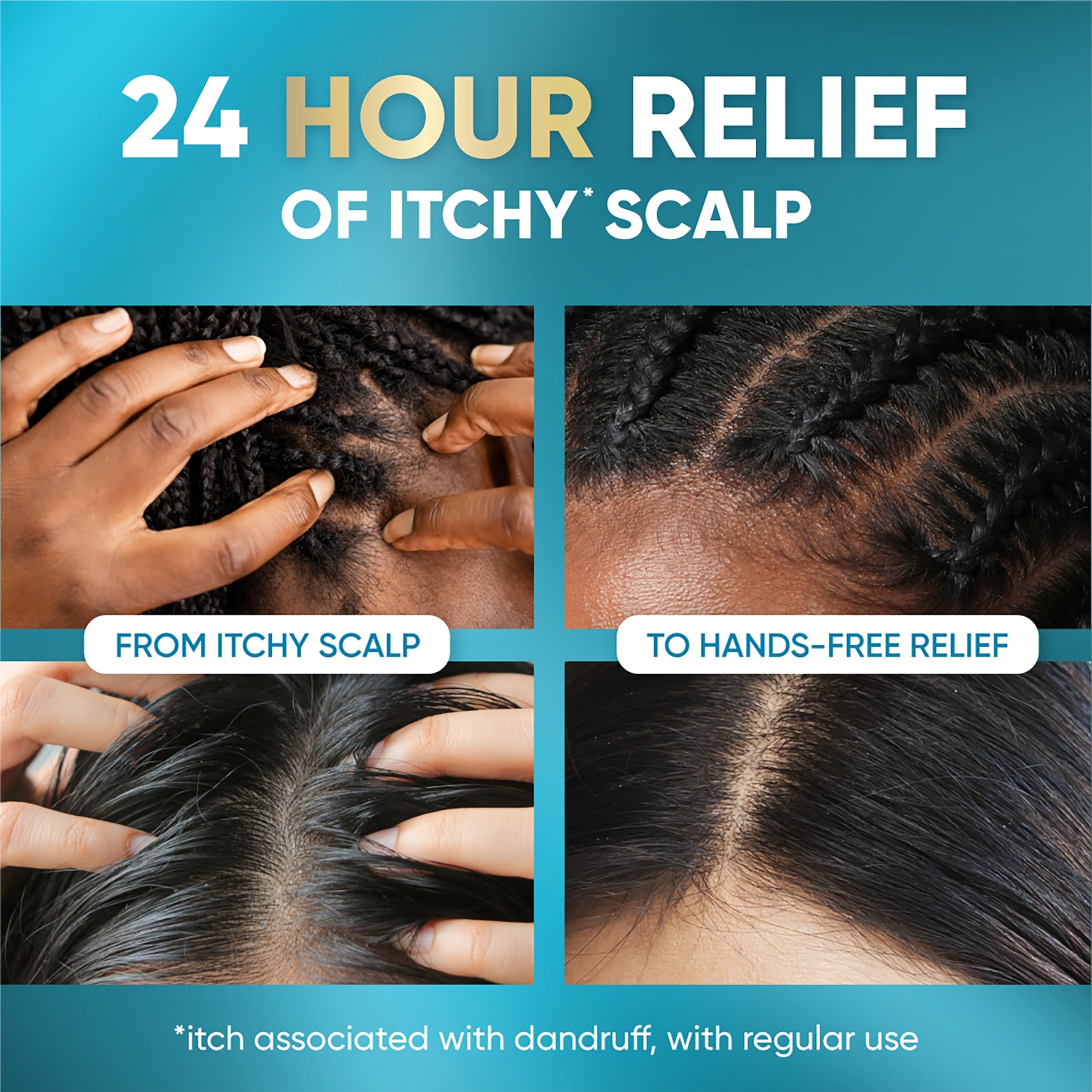 Head & Shoulders Royal Oils Instant Soothe Scalp Elixir 4.2 fl.oz - No-Rinse Scalp Relief for Textured Hair 4