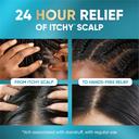 Head & Shoulders Royal Oils Instant Soothe Scalp Elixir 4.2 fl.oz - No-Rinse Scalp Relief for Textured Hair 4