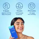 Differin Adapalene Gel 1.6 oz (Pump) - Retinoid Acne Treatment for Face with 0.1% Adapalene 3