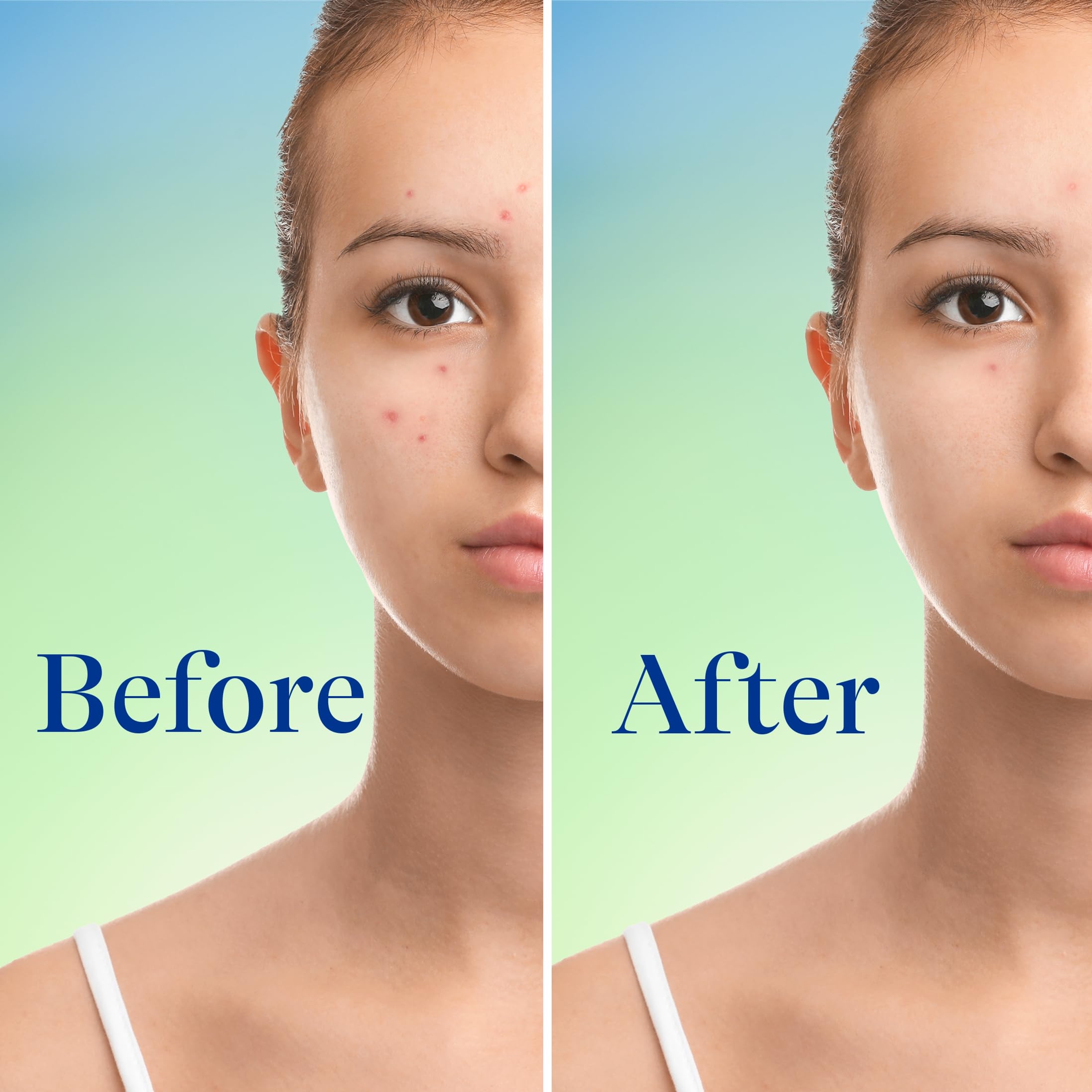 Differin Acne Foaming Cleanser 5 fl.oz - Acne Face Wash with 10% Benzoyl Peroxide for Face & Body 6