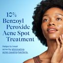 Differin 10% Benzoyl Peroxide Spot Treatment 1 oz - Fast-Acting Pimple Treatment, Clears Acne Overnight 7