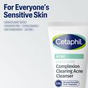 Cetaphil Gentle Clear Complexion Clearing Acne Cleanser 4.2 fl.oz - BPO Acne Face Wash Soothes for Sensitive Skin 7