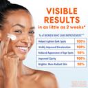 Palmer's Anti-Dark Spot Fade Cream 2.7 oz - Helps Reduce Dark Spots, Evens Skin Tone for All Skin Types 2
