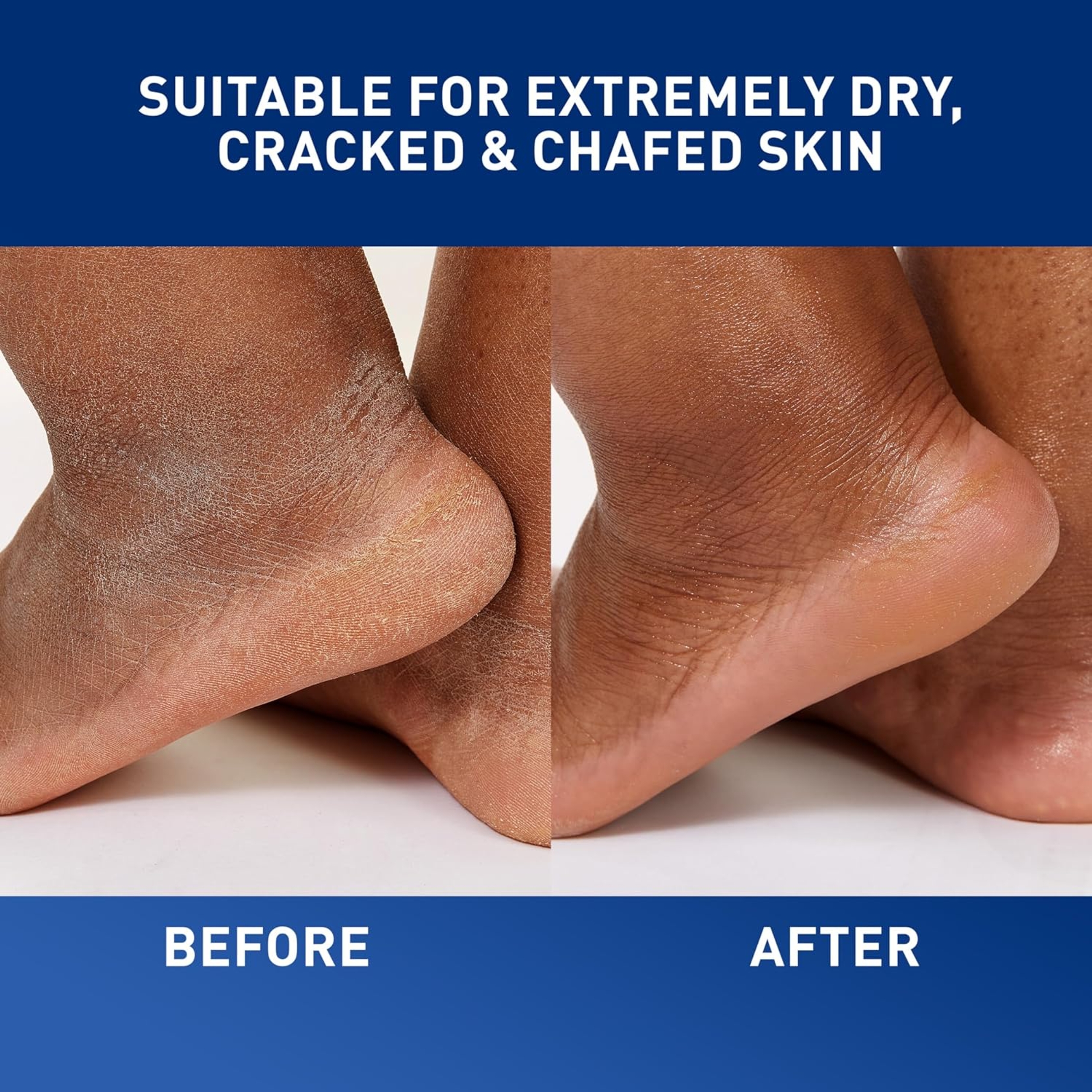 CeraVe Healing Ointment 12 oz - Barrier Cream Protects & Soothes Dry, Cracked & Chafed Skin 5