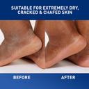 CeraVe Healing Ointment 12 oz - Barrier Cream Protects & Soothes Dry, Cracked & Chafed Skin 5