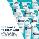 CeraVe Acne Foaming Cream Cleanser 5 fl.oz - Face Wash with 4% Benzoyl Peroxide Helps Clear Acne & Blackheads 2